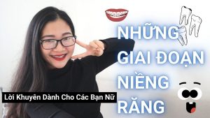 Read more about the article Mình Đã Trải Qua Những Giai Đoạn Gì Khi Niềng Răng? Lời Khuyên Dành Cho Các Bạn Nữ Muốn Niềng Răng
